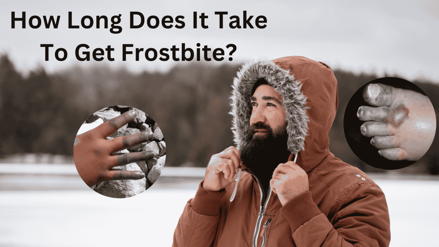 How Long Does It Take to Get Frostbite? Stages, Risks & Prevention